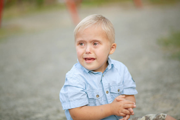 障害のある子供の日常生活。ダウン症の少年が泣いている。赤ちゃんの染色体と遺伝性障害. - 写真・画像