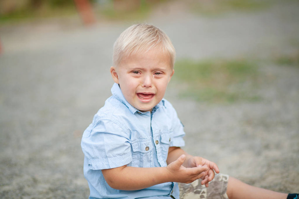 障害のある子供の日常生活。ダウン症の少年が泣いている。赤ちゃんの染色体と遺伝性障害. - 写真・画像