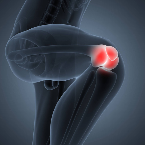 Dolori alle articolazioni delle ossa umane (articolazione del ginocchio). 3D - Illustrazione
 - Foto, immagini