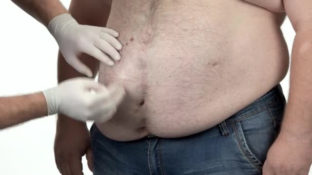 Médico en guantes de goma examinando el vientre del paciente gordo
. - Metraje, vídeo