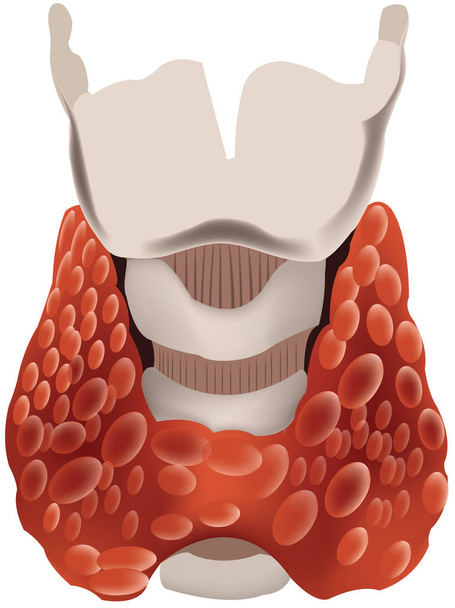 орган щитовидной железы человеческого тела
 - Вектор,изображение