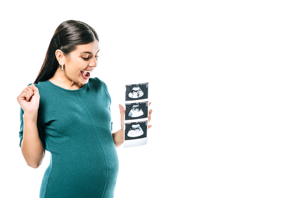 excitada embarazada sosteniendo imágenes de ultrasonido fetal aisladas en blanco
 - Foto, Imagen
