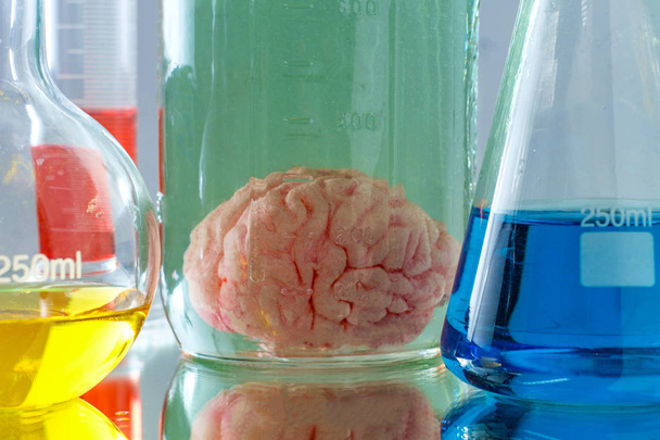 保存された人間の脳ジャー - 写真・画像