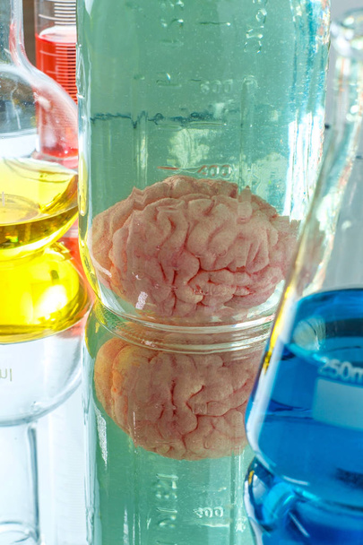 Збереження мозкового мозку людини - Фото, зображення