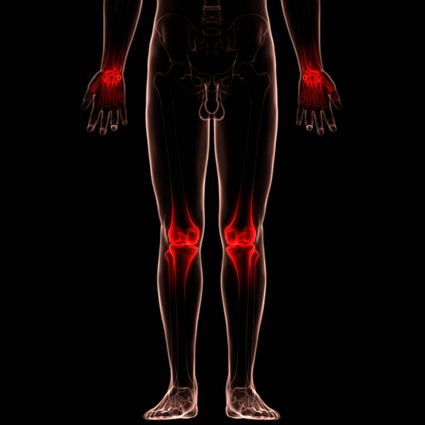 İnsan Kemiği Eklem Ağrısı Anatomisi (Diz Eklemleri). 3D - Görüntü - Fotoğraf, Görsel