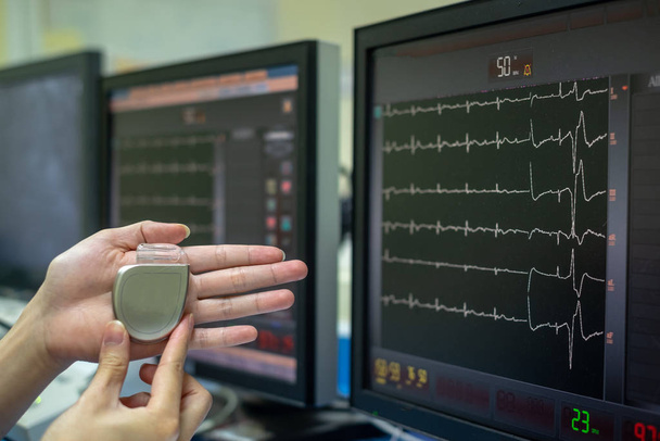 demonstra a diferença de tamanho entre marca-passo permanente (PPM) e cardioversor-desfibriladores implantáveis (CDI)
) - Foto, Imagem