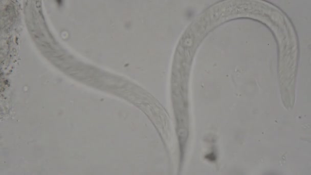 parásito: Strongyloides stercoralis de heces humanas bajo el microscopio. pruebas en laboratorio - Metraje, vídeo