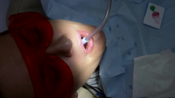 closeup. the woman visit the dentist. hands of dentist with gloves on - Séquence, vidéo