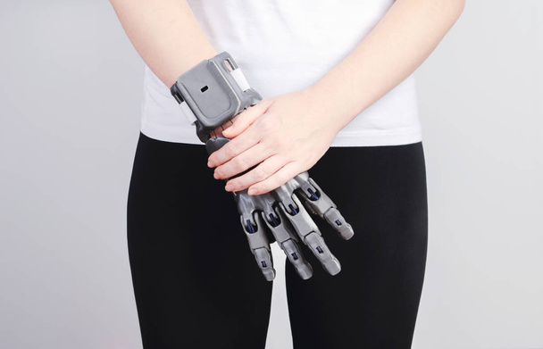 A girl with a prosthesis printed on a 3D printer folded her hands on her belt. - Valokuva, kuva