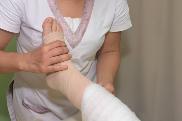 Manejo del linfedema: Envolver la pierna usando vendajes multicapa para controlar el linfedema. Parte de la terapia descongestiva completa (cdt) y drenaje linfático manual (MLD)
) - Foto, imagen