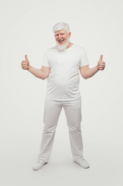 Albino man doing happy thumbs up gesture - 写真・画像