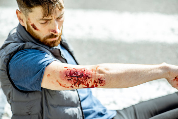 Injured man after the road accident - Valokuva, kuva