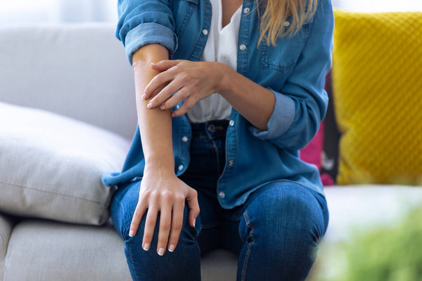 Jeune femme se gratte le bras alors qu'elle est assise sur le canapé à la maison
 - Photo, image