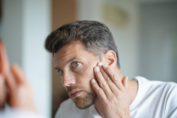 Portrait of a man worried about hair loss - Φωτογραφία, εικόνα