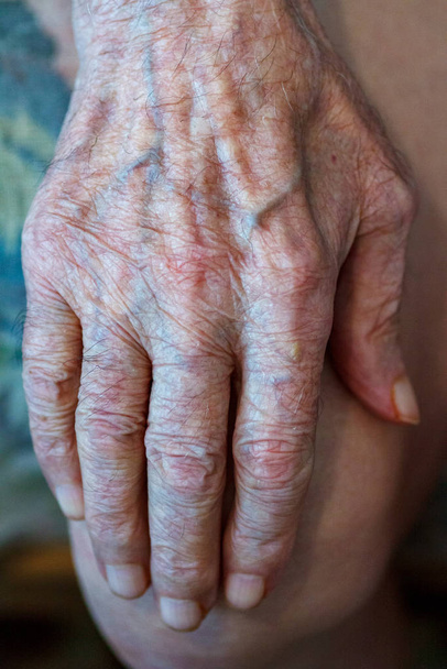 Proces stárnutí lidské kůže - vrásčité ruce velmi starého muže, který žil 90-100 let se suchou kůží pokrytou vráskami a skvrnami - Fotografie, Obrázek