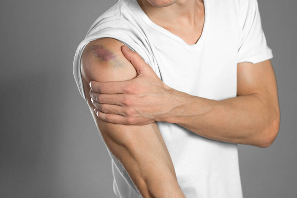 The bruise on the shoulder. Shoulder pain. The man holds his han - Fotografie, Obrázek