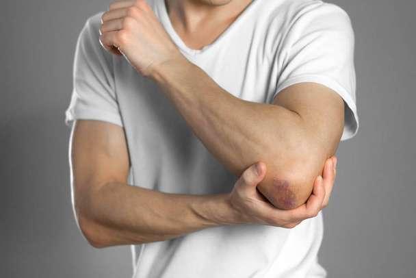 The bruise on the elbow. Pain in the elbow. The man holds his ha - Photo, image