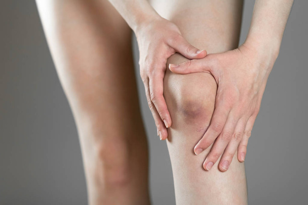 The bruise on his knee. Knee pain. The woman holds her leg. Clos - Φωτογραφία, εικόνα