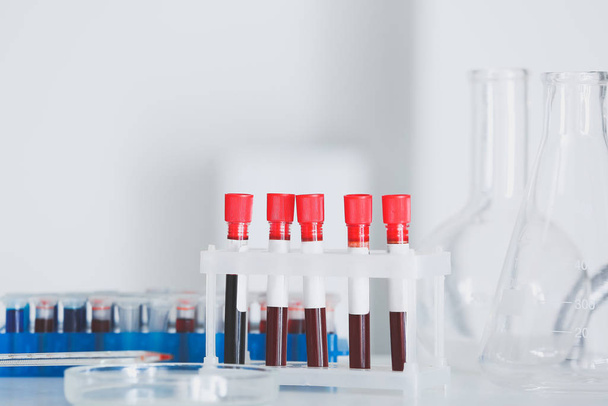 Reageerbuisjes met bloedmonsters op tafel in laboratorium - Foto, afbeelding