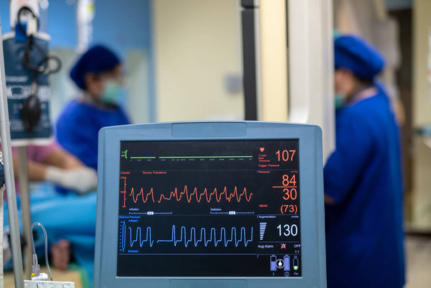 Moniteur EKG dans la machine de pompe à ballon intra aortique. Matériel médical. Technologie médicale
 - Photo, image