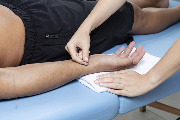 Détail du thérapeute ajustant les aiguilles d'acupuncture sur la main de l'homme dans le traitement d'aculpulture
. - Photo, image