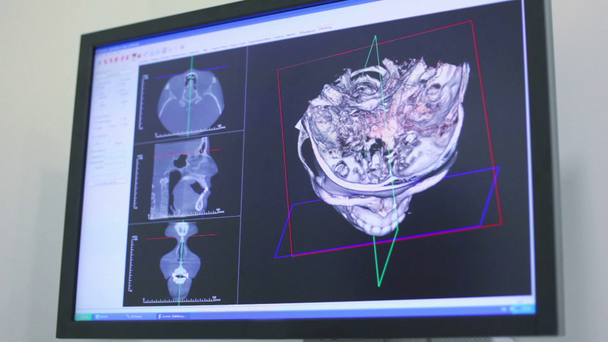 Echografie foto van schedel draait op scherm close-up - Video