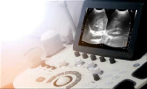 Hintergrund medizinischer Geräte, Ultraschallgerät aus nächster Nähe - Foto, Bild