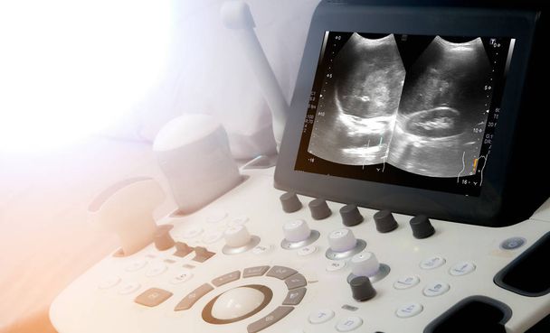 un fond d'équipement médical, une machine à ultrasons en gros plan - Photo, image
