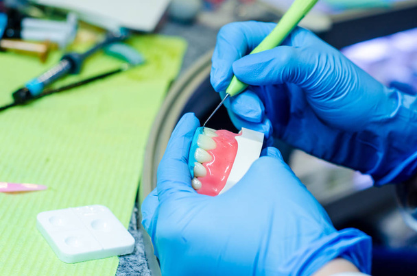Detailní záběr výrobního procesu zubního protézy. Rekonstrukce zubu. - Fotografie, Obrázek