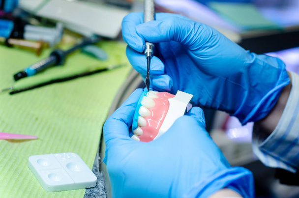 Primer plano del proceso de fabricación de prótesis dentales. Reconstrucción dental
. - Foto, imagen