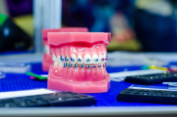 Modèle de dents de démonstration de support orthodontique ou d'attelle
 - Photo, image