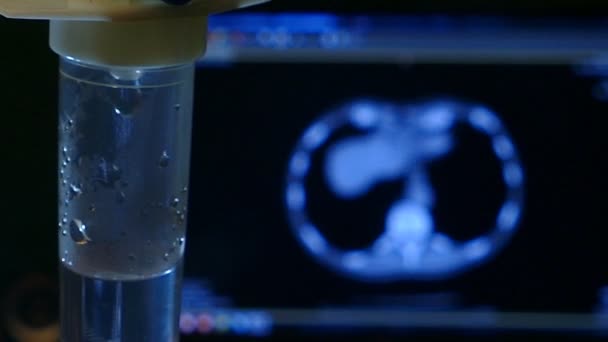 I.V. Внутривенная физраствор капельница с фоном Patient Monitor в отделении скорой помощи, крупный план
 - Кадры, видео