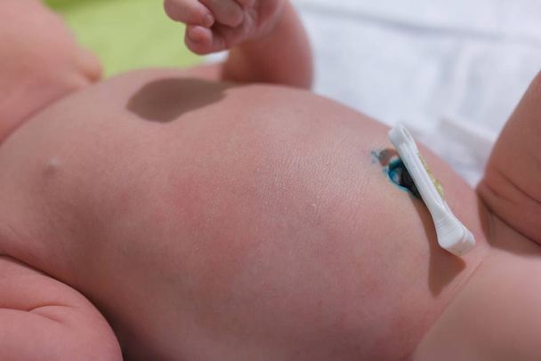 plastik göbek kıskaçlı yeni doğan bebek - Fotoğraf, Görsel