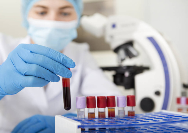 Asistente de laboratorio borroso en ropa médica protectora eligiendo la muestra de sangre
 - Foto, Imagen