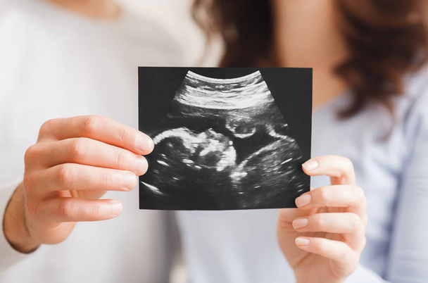 Budoucí rodiče na ultrazvukovém skenu jejich budoucího dítěte - Fotografie, Obrázek
