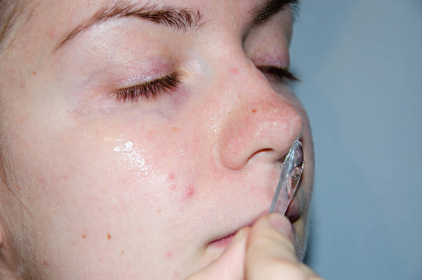 Uma garota europeia está aplicando cosméticos coreanos em sua máscara facial. Limpa poros, graxa, acne, rugas. Close-up rosto de uma menina com problemas de pele. Mousse, spray, esfoliação facial e lavagem facial. Esponja amarela
 - Foto, Imagem