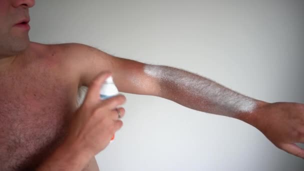 Haariger Mann trägt Spray-Medizin auf sonnengebräunte Haut auf. Gimbalenbewegung - Filmmaterial, Video