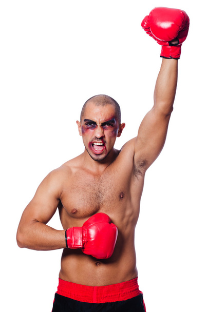 Badly beaten boxer - Photo, Image