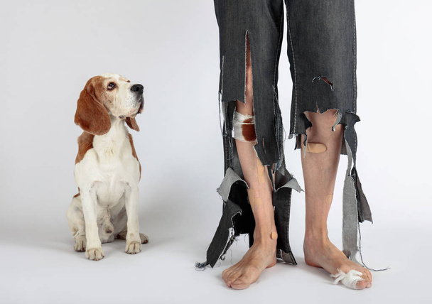  Beagle e seu dono em calças rasgadas e pés mordidos
. - Foto, Imagem