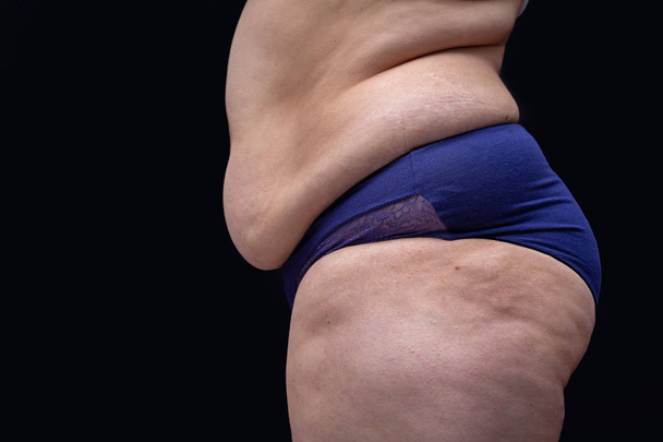 cuerpo femenino gordo
 - Foto, imagen