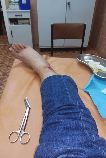 Um médico de luvas azuis examina uma ferida na perna. Faz uma ligadura. ligadura na perna do doente
. - Foto, Imagem