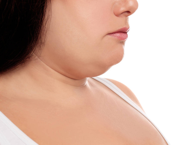 Mujer con barbilla doble sobre fondo blanco, primer plano
 - Foto, imagen