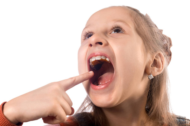 Petite fille mignonne montre son appareil orthodontique sur un dos blanc
 - Photo, image