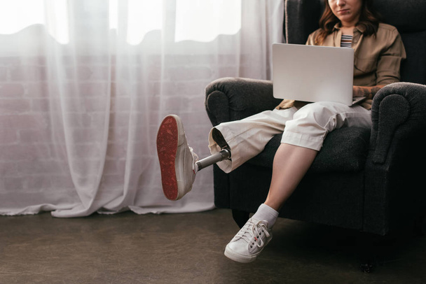 Cropped view of woman with prosthetic leg working at laptop in armchair - Foto, Imagen