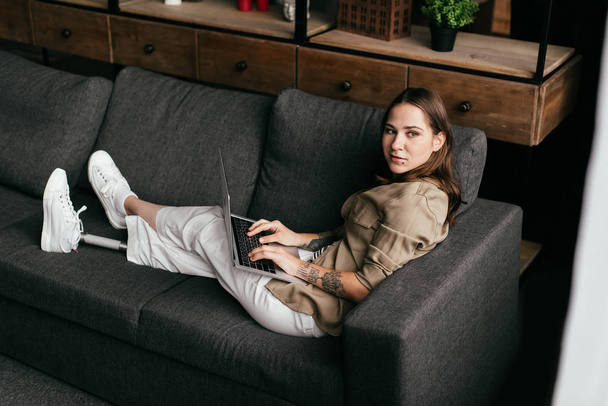 Protez bacaklı genç bir kadın dizüstü bilgisayarını tutuyor ve kanepeye bakıyor. - Fotoğraf, Görsel