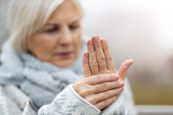 Senior woman with arthritis rubbing hands - Fotografie, Obrázek