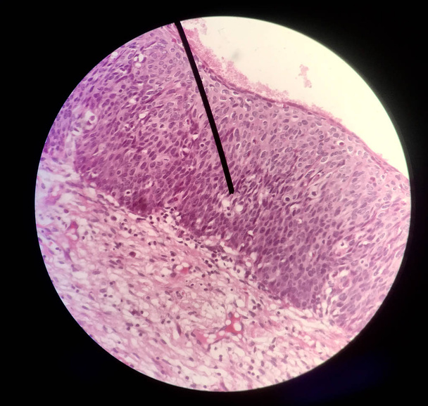 Sejtek a reproduktív női citológiában és szövettani koncepcióban. - Fotó, kép