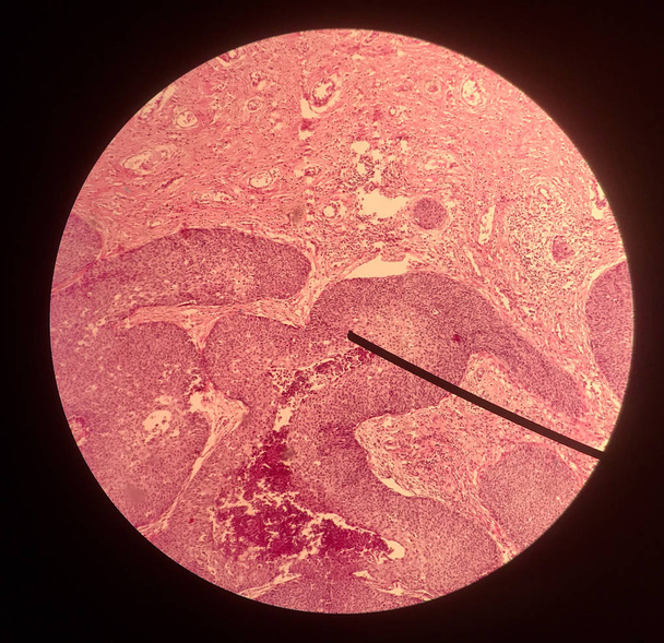 Cells in reproductive female cytology and histology concept. - Photo, Image