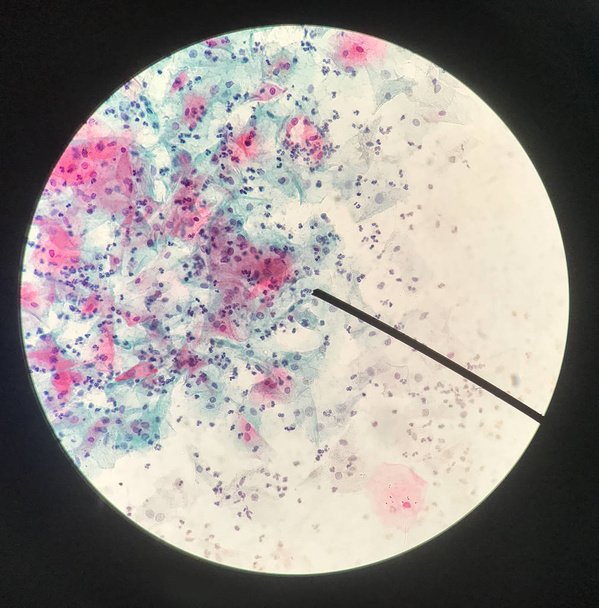 Cellen in reproductieve vrouwelijke cytologie en histologie concept. - Foto, afbeelding