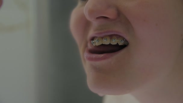 Kız Diş tellerini Temizler - Video, Çekim